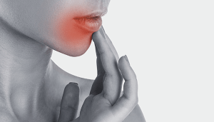 Oral herpes