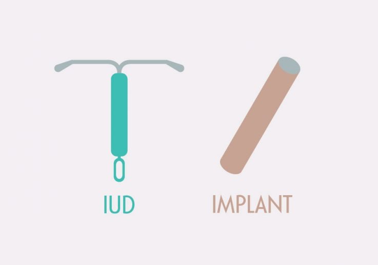 LARC: Long-acting reversible contraception