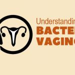 Understanding Women’s Experiences with Bacterial Vaginosis