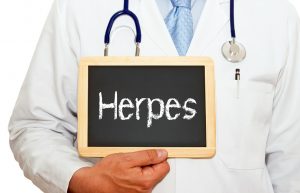 Doctor holding a sign that says herpes