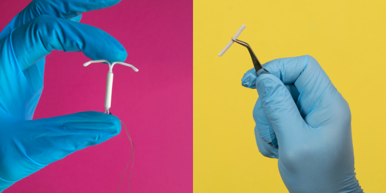 LARC options—implant and IUD
