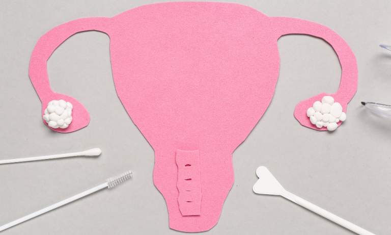 A uterus