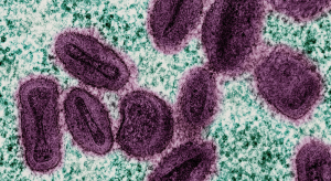 Mpox virus
