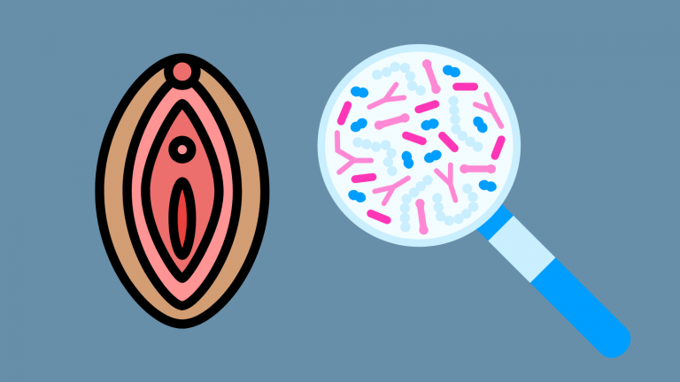Bacterial vaginosis