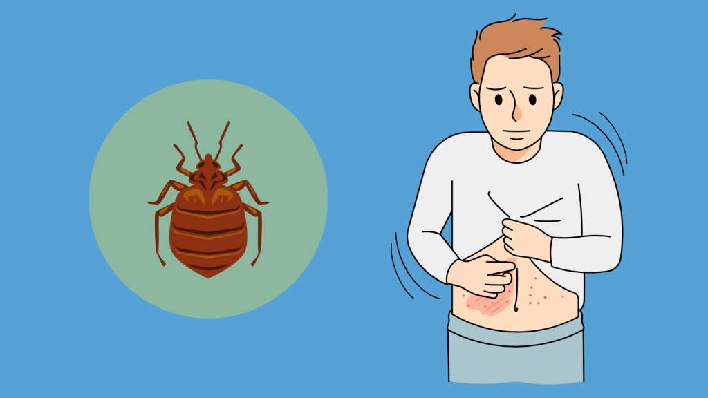 A person with lesions on their abdomen from scabies