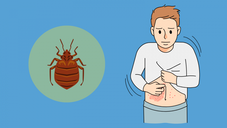 A person with lesions on their abdomen from scabies