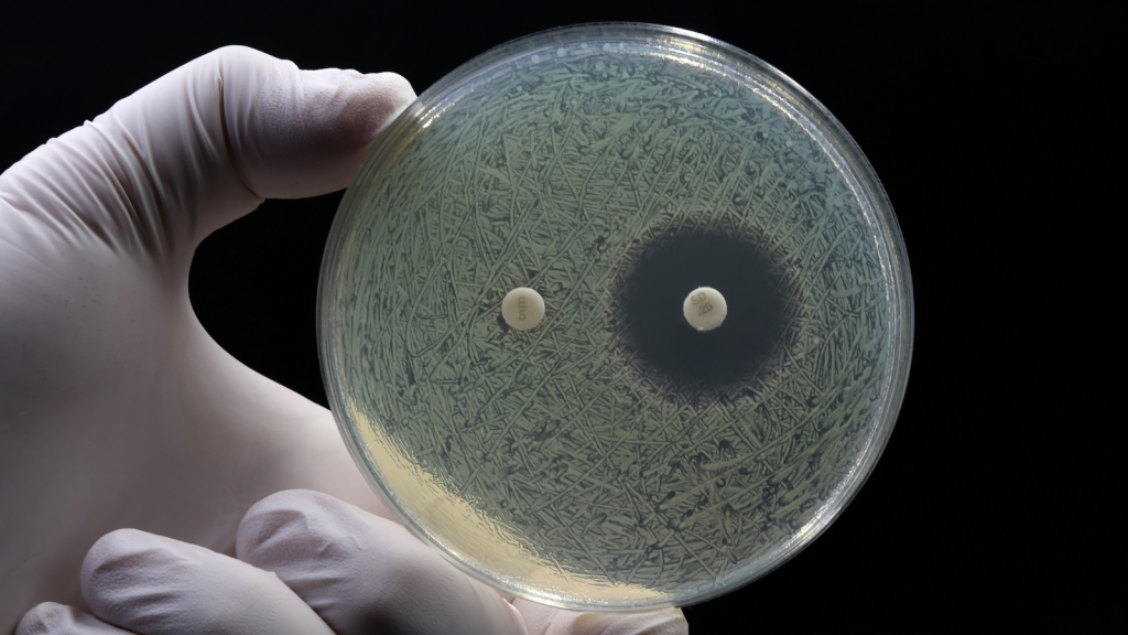 A petri dish demonstrating antibiotic resistance