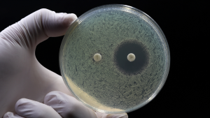 A petri dish demonstrating antibiotic resistance